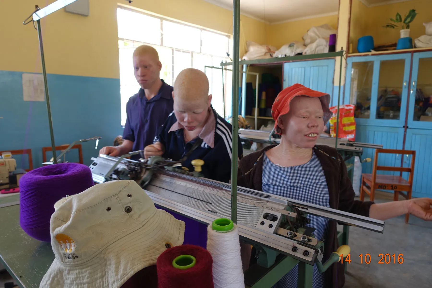 Albinos an der Strickmaschine in der 